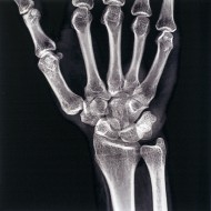 Mid 20th century X-ray photog...